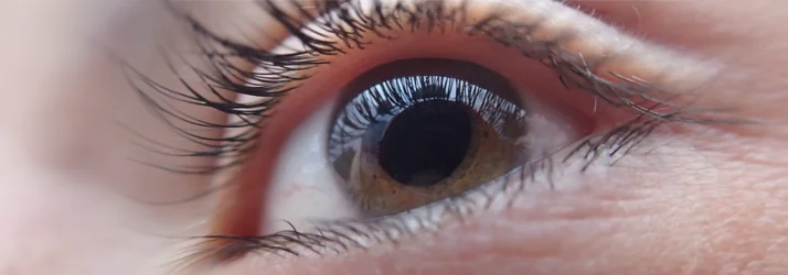 Dry Eye Test in Bainbridge Island WA – FC Dry Eye Test in Bainbridge Island WA – FC